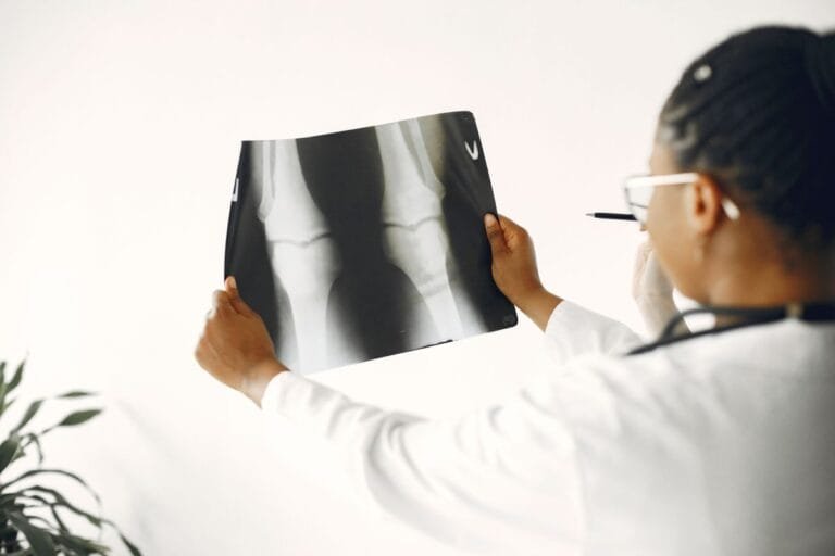 Doctor examining a knee X-ray