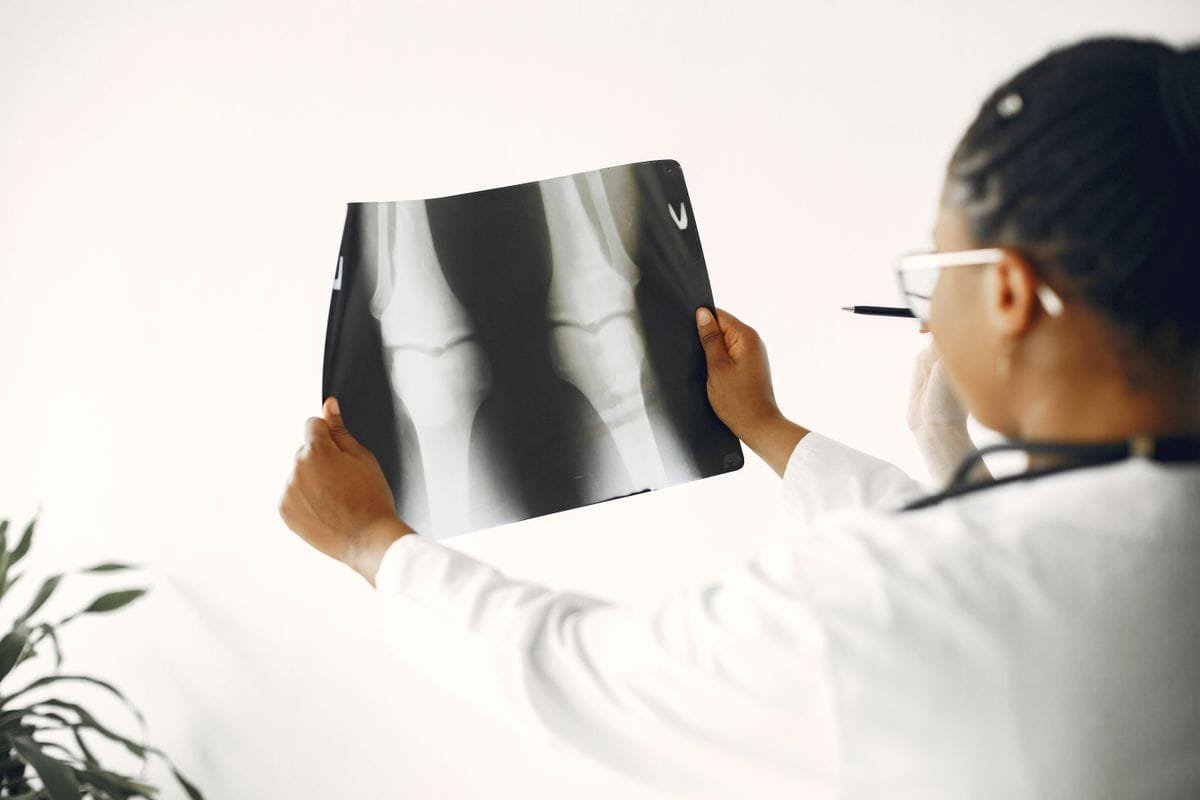 Doctor examining a knee X-ray