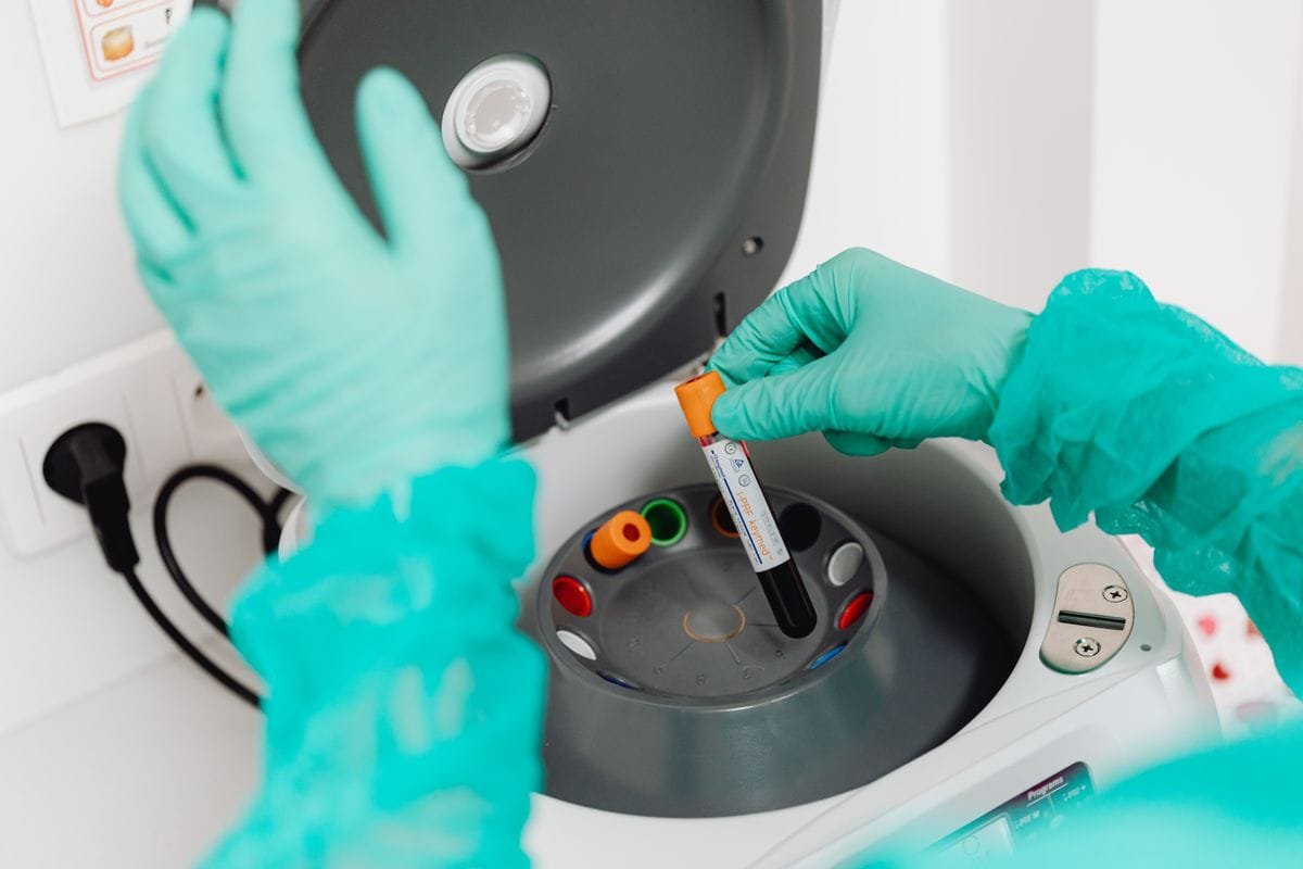 Rheumatologist in Bhubaneswar 6 Rheumatology Laboratory at OARC
